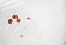 The Best Way To Remove Blood From Sheets.