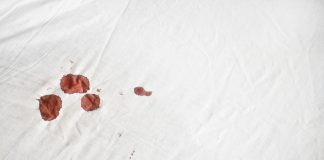 The Best Way To Remove Blood From Sheets.