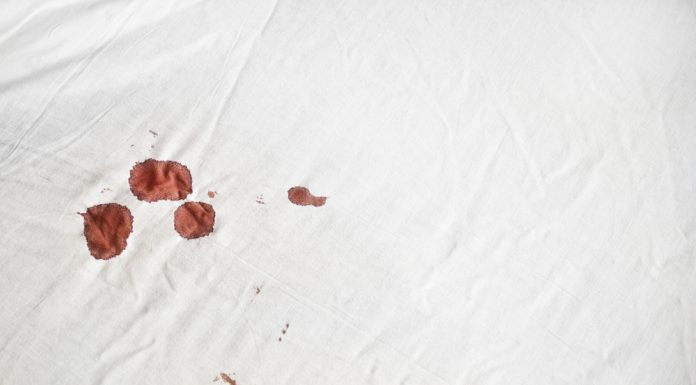 The Best Way To Remove Blood From Sheets.