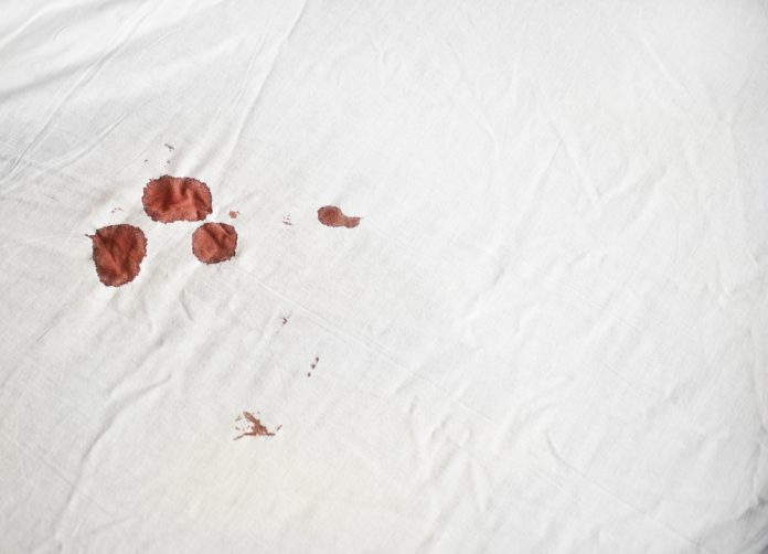 The Best Way To Remove Blood From Sheets. Grandma's Things