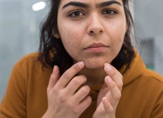 6 Possible Explanations Why Some Women Have Hair On Their Chins.