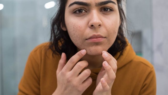 6 Possible Explanations Why Some Women Have Hair On Their Chins. - Health 2024 | PopcornTime