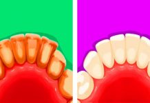 Natural Ways To Fight Tartar Build-Up At Home.
