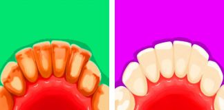 Natural Ways To Fight Tartar Build-Up At Home.