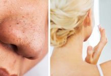 DIY Face Mask To Deep Clean Your Pores