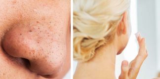 DIY Face Mask To Deep Clean Your Pores