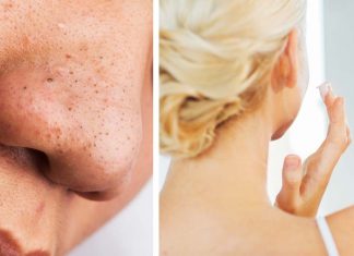 DIY Face Mask To Deep Clean Your Pores