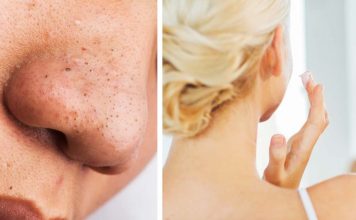DIY Face Mask To Deep Clean Your Pores