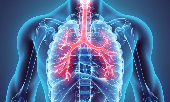 These Are 9 Best Herbs for Lung Cleansing and Respiratory Support - Health 2024 | PopcornTime