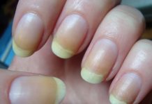 6 Of The Best Ways To Brighten Your Nails At Home.