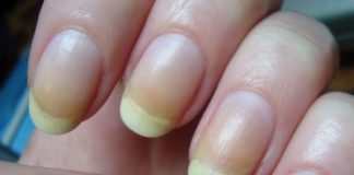 6 Of The Best Ways To Brighten Your Nails At Home.