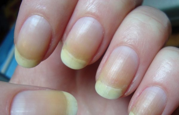 6 Of The Best Ways To Brighten Your Nails At Home.