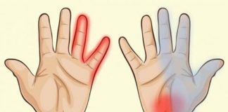 this Is What Your Hands Say About your Health