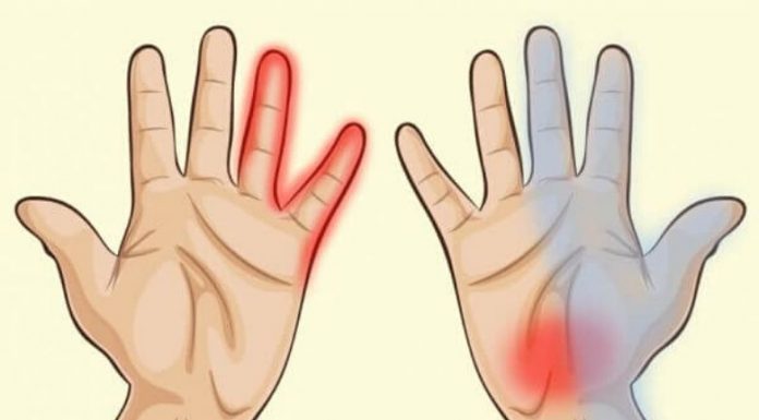 this Is What Your Hands Say About your Health