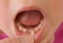 Scientists Are Encouraging Parents To Keep Their Kids’ Baby Teeth
