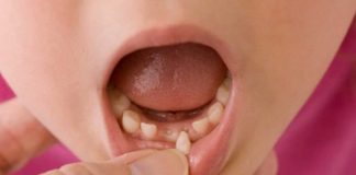 Scientists Are Encouraging Parents To Keep Their Kids’ Baby Teeth