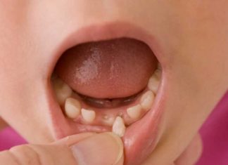 Scientists Are Encouraging Parents To Keep Their Kids’ Baby Teeth