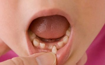 Scientists Are Encouraging Parents To Keep Their Kids’ Baby Teeth