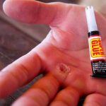 5 Nurse-Approved Hacks To Help With Minor Issues