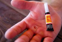 5 Nurse-Approved Hacks To Help With Minor Issues