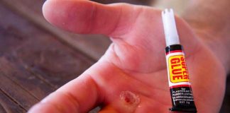 5 Nurse-Approved Hacks To Help With Minor Issues