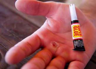 5 Nurse-Approved Hacks To Help With Minor Issues