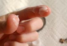 If a nurse were your best friend, she would tell you these 8 tips