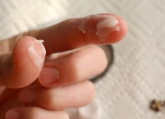 If a nurse were your best friend, she would tell you these 8 tips