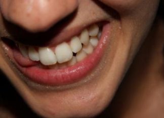 How to Remove Plaque From Your Teeth in Just 2 Minutes