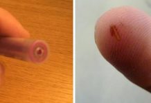 Mom Shares Genius Trick For Removing Splinters