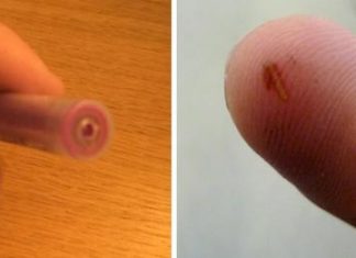 Mom Shares Genius Trick For Removing Splinters