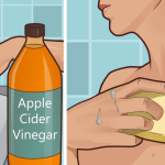 Effects of apple cider vinegar on skin