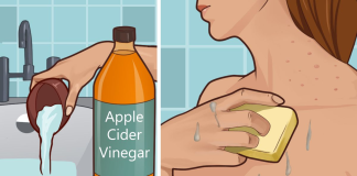 Effects of apple cider vinegar on skin