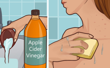 Effects of apple cider vinegar on skin