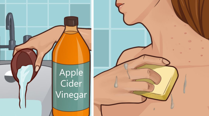 Effects of apple cider vinegar on skin