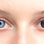 Unique Photos That Show How Unpredictable Genetics Can Be