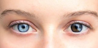 Unique Photos That Show How Unpredictable Genetics Can Be