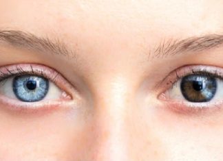 Unique Photos That Show How Unpredictable Genetics Can Be