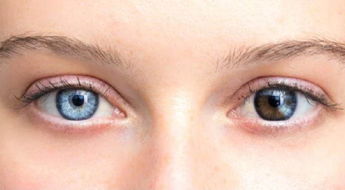 Unique Photos That Show How Unpredictable Genetics Can Be