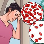 Headaches and fatigue are common symptoms of anemia. Here are 6 ways to treat it naturally