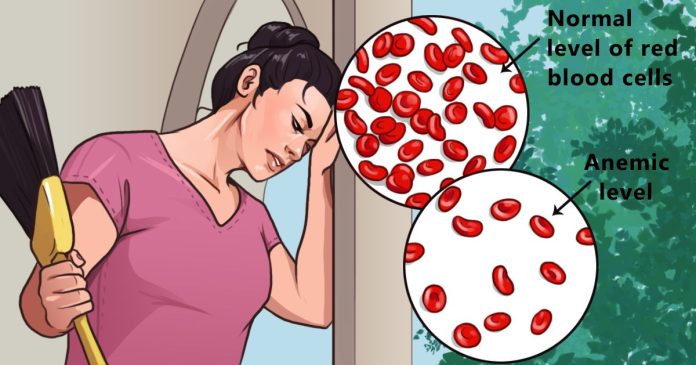 Headaches and fatigue are common symptoms of anemia. Here are 6 ways to treat it naturally - Health 2024 | PopcornTime