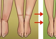 Ways to deal with bloating from water weight gain