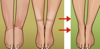 Ways to deal with bloating from water weight gain