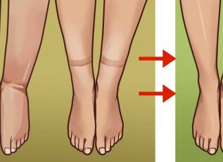 Ways to deal with bloating from water weight gain