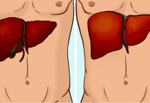 How to spot liver failure and what to do for treatment