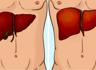 How to spot liver failure and what to do for treatment