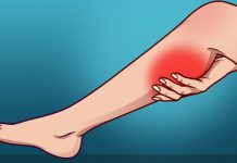 How to treat and prevent leg cramps at night