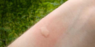 14 Surprising Ways To Use Rubbing Alcohol