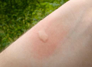 14 Surprising Ways To Use Rubbing Alcohol