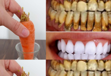 Teeth whitening in just 2 minutes – turning yellow and accumulated tartar into milk-like white and shiny.